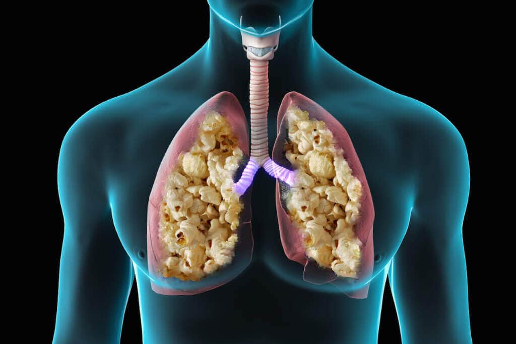 popcorn lung symptoms nhs