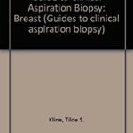 Breast : Guides to Clinical Aspiration Biopsy by Tilde S. Kline